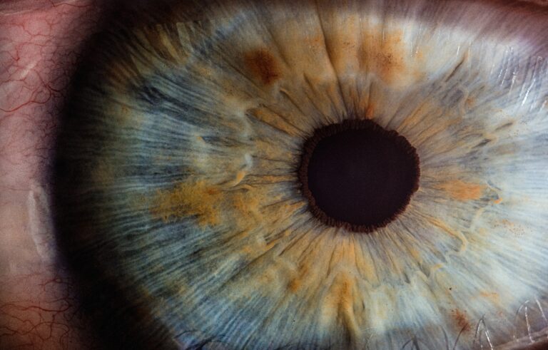 Looking after your eyes - Cathedral Eye Clinic