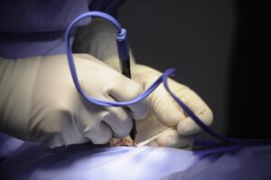 Oculoplastic Surgery Blog Image - Cathedral Eye Clinic