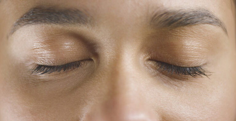 Electrolysis for Ingrown Eyelashes