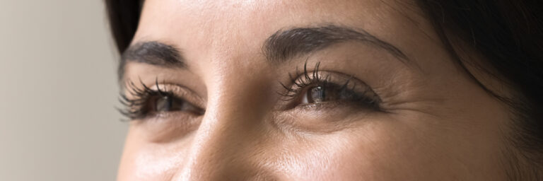 Upper Blepharoplasty (Eyelid Surgery)